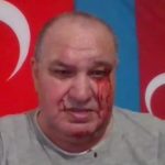 Азербайджанский диссидент Видади Искендерли жестоко избит во Франции