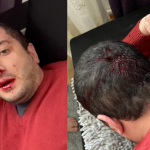 Азербайджанский оппозиционный блогер подвергся нападению в Берлине